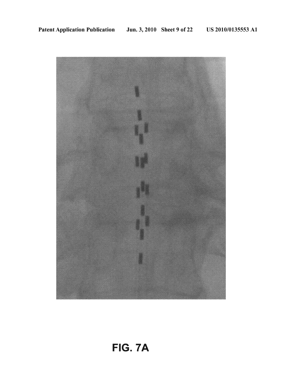 IMAGE-BASED CHARACTERIZATION OF IMPLANTED MEDICAL LEADS - diagram, schematic, and image 10