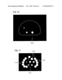 METHOD AND APPARATUS FOR ESTABLISHING A POSITION OF A PHANTOM IN AN IMAGE QUALITY TEST diagram and image