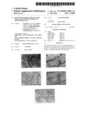 USE OF THE ENDOGLYCOSIDASE ENDOS FOR TREATING IMMUNOGLOBULIN G MEDIATED DISEASES diagram and image