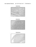 ANTI-CXCR1 COMPOSITIONS AND METHODS diagram and image