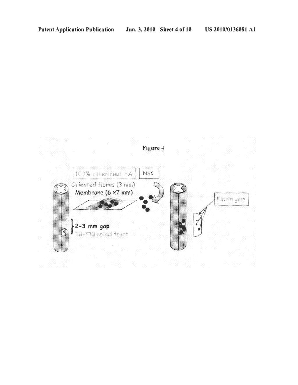 HYALURONIC ACID DERIVATIVE AND NEURAL STEM CELLS FOR SCI AND PNT REGENERATION - diagram, schematic, and image 05