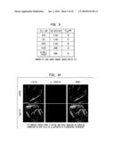 TREATMENT OF LUNG CANCER diagram and image