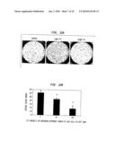 TREATMENT OF LUNG CANCER diagram and image