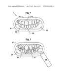 Mouthpiece Devices and Methods to Allow UV Whitening of Teeth diagram and image