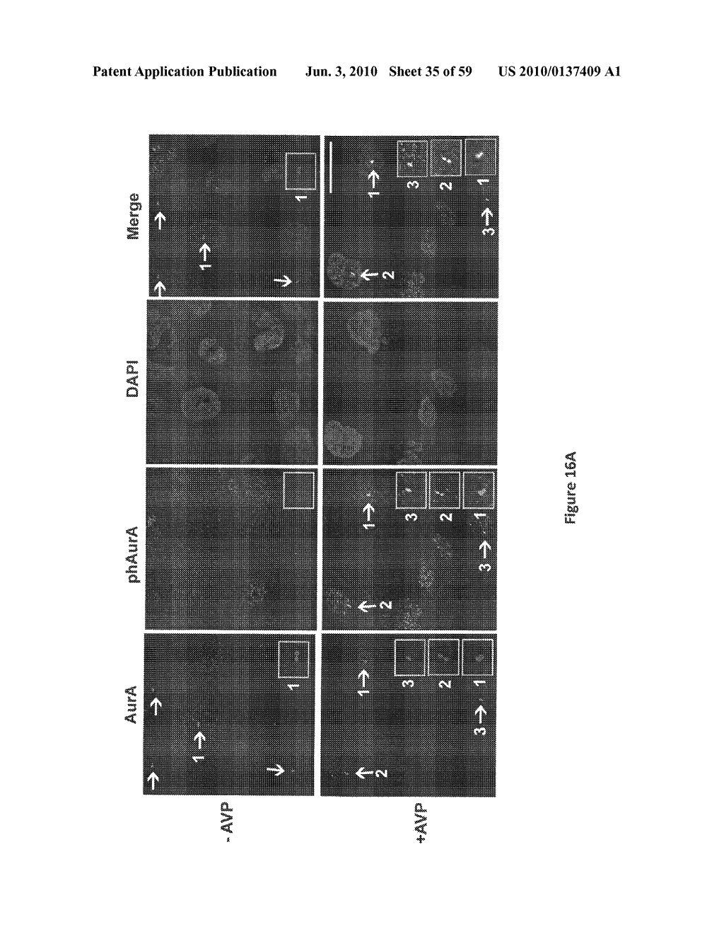 Compositions and Methods for the Treatment of Diseases Associated with Aberrant Cilia Assembly and Regulation - diagram, schematic, and image 36