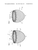 SELF-ADJUSTING ATTACHMENT STRUCTURE FOR A CARDIAC SUPPORT DEVICE diagram and image