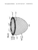 SELF-ADJUSTING ATTACHMENT STRUCTURE FOR A CARDIAC SUPPORT DEVICE diagram and image