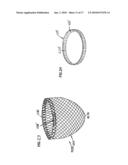 SELF-ADJUSTING ATTACHMENT STRUCTURE FOR A CARDIAC SUPPORT DEVICE diagram and image