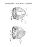 SELF-ADJUSTING ATTACHMENT STRUCTURE FOR A CARDIAC SUPPORT DEVICE diagram and image