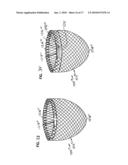 SELF-ADJUSTING ATTACHMENT STRUCTURE FOR A CARDIAC SUPPORT DEVICE diagram and image