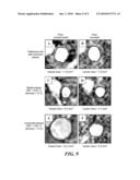 Apparatus and Method of Analyzing Arterial Plaque diagram and image