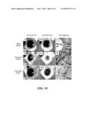 Apparatus and Method of Analyzing Arterial Plaque diagram and image