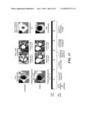 Apparatus and Method of Analyzing Arterial Plaque diagram and image