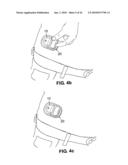 DETACHABLE PORTABLE INFUSION DEVICE diagram and image