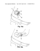 DETACHABLE PORTABLE INFUSION DEVICE diagram and image