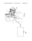 ATRAUMATIC EAR IRRIGATION DEVICE diagram and image