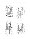 Needle tip guard for percutaneous entry needles diagram and image