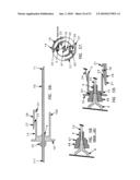 Needle tip guard for percutaneous entry needles diagram and image