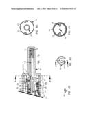 Needle tip guard for percutaneous entry needles diagram and image