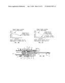 Needle tip guard for percutaneous entry needles diagram and image