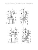 Needle tip guard for percutaneous entry needles diagram and image