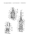 Needle tip guard for percutaneous entry needles diagram and image