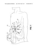 System and Method for Mechanical Closure of Wounds diagram and image