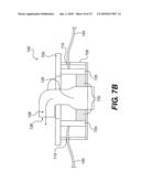 System and Method for Mechanical Closure of Wounds diagram and image