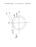 MULTIPLE-SPOT LASER REFRACTIVE OPHTHALMIC SURGERY diagram and image