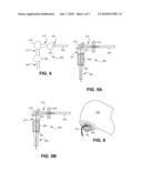 NON-CONTACT HANDPIECE FOR LASER TISSUE CUTTING diagram and image