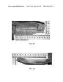 METHODS AND DEVICES FOR APPLYING ENERGY TO BODILY TISSUES diagram and image