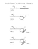 METHODS AND DEVICES FOR APPLYING ENERGY TO BODILY TISSUES diagram and image