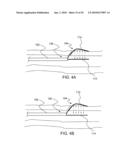 METHODS AND DEVICES FOR APPLYING ENERGY TO BODILY TISSUES diagram and image