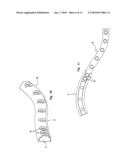 METHOD AND SYSTEM FOR THE INTRAMEDULLARY FIXATION OF A FRACTURED BONE diagram and image