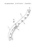 METHOD AND SYSTEM FOR THE INTRAMEDULLARY FIXATION OF A FRACTURED BONE diagram and image