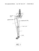 SYSTEMS AND METHODS FOR JOINT REPLACEMENT diagram and image