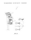 SYSTEMS AND METHODS FOR JOINT REPLACEMENT diagram and image