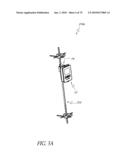 SYSTEMS AND METHODS FOR JOINT REPLACEMENT diagram and image