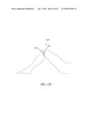 SYSTEMS AND METHODS FOR JOINT REPLACEMENT diagram and image