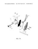 SYSTEMS AND METHODS FOR JOINT REPLACEMENT diagram and image