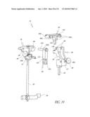 SYSTEMS AND METHODS FOR JOINT REPLACEMENT diagram and image