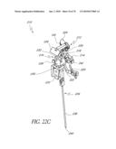 SYSTEMS AND METHODS FOR JOINT REPLACEMENT diagram and image