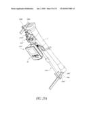 SYSTEMS AND METHODS FOR JOINT REPLACEMENT diagram and image