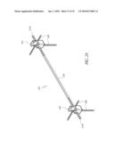 SYSTEMS AND METHODS FOR JOINT REPLACEMENT diagram and image