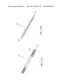 SYSTEMS AND METHODS FOR JOINT REPLACEMENT diagram and image