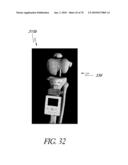 SYSTEMS AND METHODS FOR JOINT REPLACEMENT diagram and image