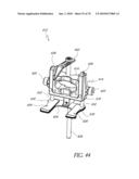 SYSTEMS AND METHODS FOR JOINT REPLACEMENT diagram and image