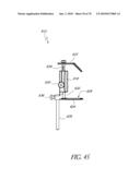 SYSTEMS AND METHODS FOR JOINT REPLACEMENT diagram and image