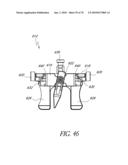 SYSTEMS AND METHODS FOR JOINT REPLACEMENT diagram and image