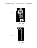 SYSTEMS AND METHODS FOR JOINT REPLACEMENT diagram and image